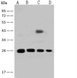 GSTT2B Antibody, Novus Biologicals 50 &mu;g | Buy Online | Novus Biologicals | Fisher Scientific