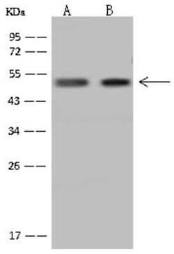 GTF2A1L Antibody, Novus Biologicals 50 &mu;g, Unconjugated:Antibodies,
