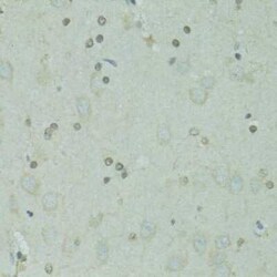 GTF2H2C Antibody - BSA Free, Novus Biologicals 100 &mu;g; Unconjugated:Antibodies,