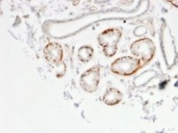 GTF2H2C Antibody (PCRP-GTF2H2C-2C9) - Azide and BSA Free, Novus Biologicals