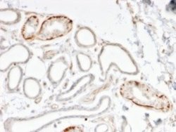 GTF2H2C Antibody (PCRP-GTF2H2C-2C9) - Azide and BSA Free, Novus Biologicals