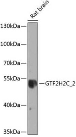 GTF2H2D Antibody - BSA Free, Novus Biologicals:Antibodies:Primary Antibodies