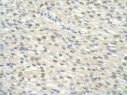 GTF2H3 Antibody, Novus Biologicals 100 &mu;L | Buy Online | Novus Biologicals | Fisher Scientific