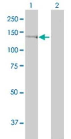 Novus Biologicals GTF2IRD1 Antibody (1D2), Novus Biologicals 0.1 mg | Buy Online | Novus Biologicals&trade; | Fisher Scientific
