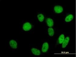 GTF3C2 Antibody, Novus Biologicals 0.05 mg | Buy Online | Novus Biologicals | Fisher Scientific