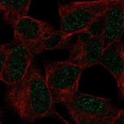 GTF3C2 Rabbit anti-Human, Polyclonal, Novus Biologicals 100 &mu;g; Unconjugated:Antibodies,