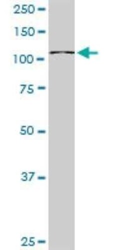 GTF3C2 Antibody, Novus Biologicals 0.05 mg | Buy Online | Novus Biologicals | Fisher Scientific