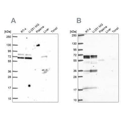 GTF3C5 Antibody, Novus Biologicals 0.1 mL, Unconjugated:Antibodies, Polyclonal