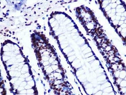GTPBP4 Rabbit anti-Human, Clone: 7O5L6, Novus Biologicals 20 &mu;g; Unconjugated:Antibodies,