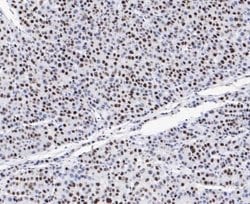 GTPBP4, Rabbit anti-Human, Clone: JE47-47, Novus Biologicals 100 uL; Unconjugated:Antibodies,