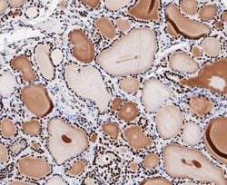 GTPBP4, Rabbit anti-Human, Clone: JE47-47, Novus Biologicals 100 uL; Unconjugated:Antibodies,