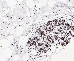 GTPBP4, Rabbit anti-Human, Clone: JE47-47, Novus Biologicals 100 uL; Unconjugated:Antibodies,