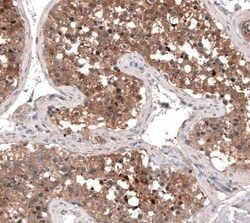 GTPBP9 Antibody, Novus Biologicals 25 &mu;L; Unconjugated:Antibodies, Polyclonal