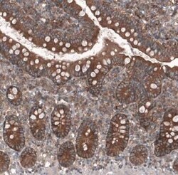 GTPBP9 Antibody, Novus Biologicals 25 &mu;L; Unconjugated:Antibodies, Polyclonal