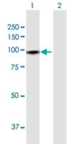 GTSE1 Antibody, Novus Biologicals 0.1 mg | Buy Online | Novus Biologicals | Fisher Scientific