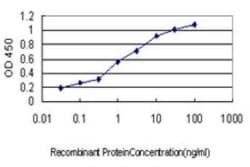 GUCY2D Antibody (6E9), Novus Biologicals 0.1 mg | Buy Online | Novus Biologicals | Fisher Scientific