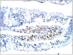 GUCY2D Antibody, Novus Biologicals 100 &mu;g | Buy Online | Novus Biologicals | Fisher Scientific