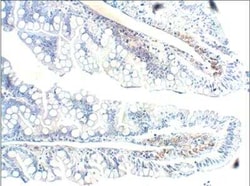 GUCY2D Antibody, Novus Biologicals 100 &mu;g | Buy Online | Novus Biologicals | Fisher Scientific