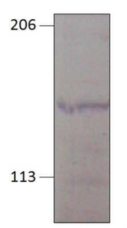 GUCY2D Antibody, Novus Biologicals 100 &mu;g | Buy Online | Novus Biologicals | Fisher Scientific