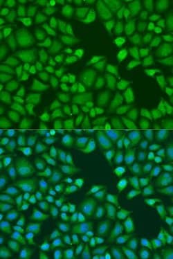 Mic1 Rabbit anti-Human, Mouse, Rat, Polyclonal, Novus Biologicals 100 &mu;L;