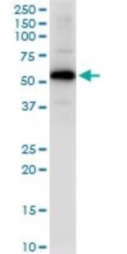 GYG2 Antibody, Novus Biologicals 0.1 mg | Buy Online | Novus Biologicals | Fisher Scientific