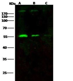 Gag polyprotein Antibody, Novus Biologicals:Antibodies:Primary Antibodies