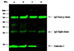 Galectin-1 Rabbit anti-Human, Clone: 1, Novus Biologicals:Antibodies:Primary