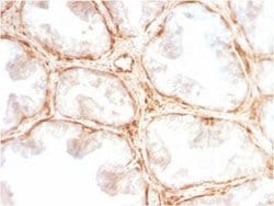 Galectin-1 Antibody (GAL1/2499R) - Azide and BSA Free, Novus Biologicals