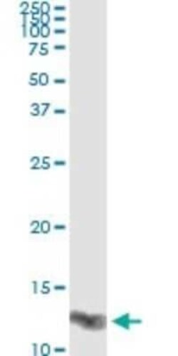 Galectin-1 Antibody (1E8-1B2), Novus Biologicals 0.1 mg | Buy Online | Novus Biologicals | Fisher Scientific