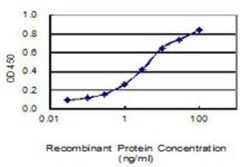 Galectin-1 Antibody (1E8-1B2), Novus Biologicals 0.1 mg | Buy Online | Novus Biologicals | Fisher Scientific