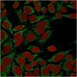Galectin-1 Antibody (GAL1/1831), Novus Biologicals 20&mu;g; Unlabeled:Antibodies,
