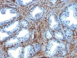 Galectin-1 Antibody (GAL1/1831), Novus Biologicals 20&mu;g; Unlabeled:Antibodies,