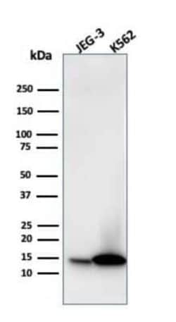 Galectin-1 Antibody (GAL1/1831), Novus Biologicals 20&mu;g; Unlabeled:Antibodies,