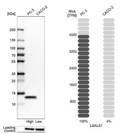 Galectin-1 Antibody, Novus Biologicals 100 &mu;L | Buy Online | Novus Biologicals | Fisher Scientific
