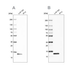 Galectin-1 Antibody, Novus Biologicals 100 &mu;L | Buy Online | Novus Biologicals | Fisher Scientific