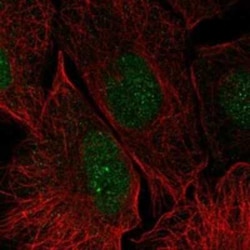 Galectin-14/LGALS14 Rabbit anti-Human, Polyclonal, Novus Biologicals 25