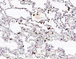 Galectin-3 Rabbit anti-Human, Clone: 102, Novus Biologicals:Antibodies:Primary