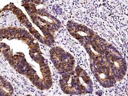 Galectin-3 Rabbit anti-Human, Clone: 102, Novus Biologicals:Antibodies:Primary