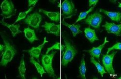 Galectin-3 Antibody (GT12712), Novus Biologicals 100 &mu;g | Buy Online | Novus Biologicals | Fisher Scientific