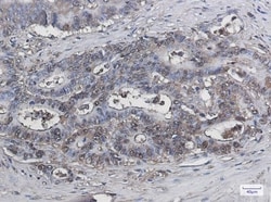 Galectin-3 Antibody (S05-8J4), Novus Biologicals:Antibodies:Primary Antibodies