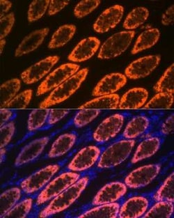 Galectin-4 Rabbit anti-Human, Mouse, Rat, Clone: 9Z2B5, Novus Biologicals