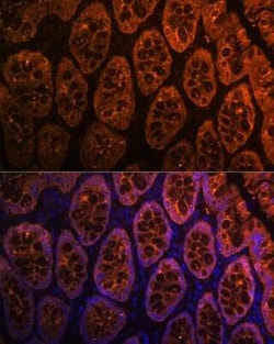 Galectin-4 Rabbit anti-Human, Mouse, Rat, Clone: 9Z2B5, Novus Biologicals