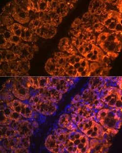 Galectin-4 Rabbit anti-Human, Mouse, Rat, Clone: 9Z2B5, Novus Biologicals
