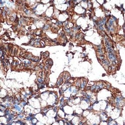 Galectin-4 Rabbit anti-Human, Mouse, Rat, Clone: 9Z2B5, Novus Biologicals