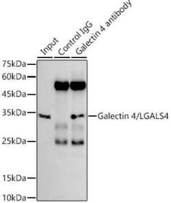 Galectin-4 Rabbit anti-Human, Mouse, Rat, Clone: 9Z2B5, Novus Biologicals