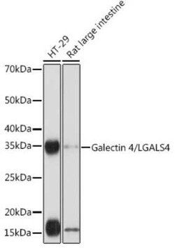 Galectin-4 Rabbit anti-Human, Mouse, Rat, Clone: 9Z2B5, Novus Biologicals