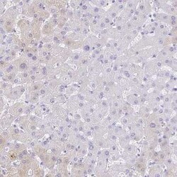 Galectin-4 Antibody, Novus Biologicals:Antibodies:Primary Antibodies