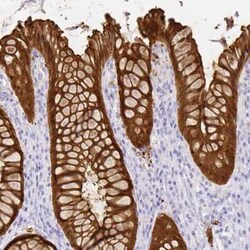 Galectin-4 Antibody, Novus Biologicals:Antibodies:Primary Antibodies