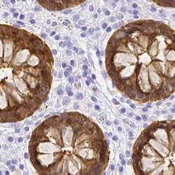 Galectin-4 Antibody, Novus Biologicals:Antibodies:Primary Antibodies