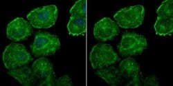 Galectin-7 Antibody (JB38-11), Novus Biologicals 100 &mu;l; Unconjugated:Antibodies,